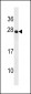 TRDC Antibody (Center)